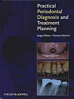 Practical Periodontal Diagnosis and Treatment Planning