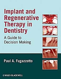 Implant and Regenerative Therapy in Dentistry: a Guide to Decision Making