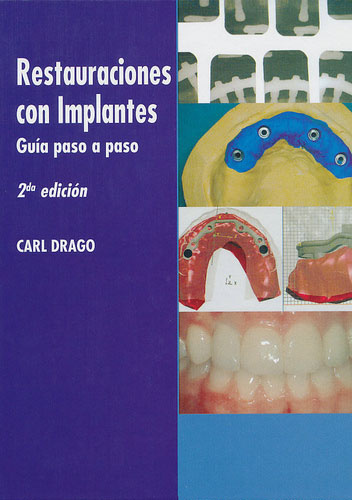 Restauraciones con Implantes. Guía Paso a Paso - C. Drago