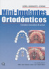 Mini-Implantes Ortodónticos - Ludwig