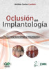 OCLUSION EN IMPLANTOLOGIA - Cardoso