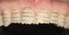 Previsualization in Esthetic Dentistry - A Useful System for Truly Informed Esthetic Treatment - Mintrone