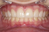 Dental Photography  for Esthetic Treatment Planing - LeSage