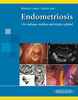 Endometriosis - Bustos López / Garza Leal