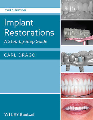 IMPLANT RESTORATIONS: A STEP-BY-STEP GUIDE 3rd EDITION - DRAGO