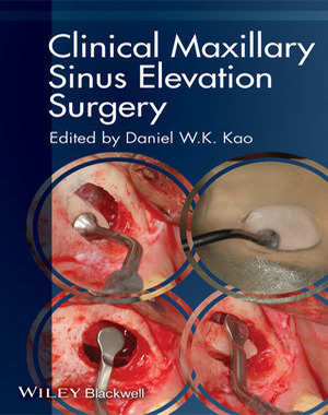 CLINICAL MAXILLARY ELEVATION SURGERY - Daniel Kao