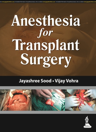 Anesthesia for Transplant Surgery -  Sood / Vohra