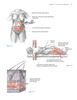 McGraw-Hill Medical, Atlas de Cirugía Plástica Contorneado Corporal - Shermak