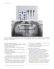 MINIIMPLANTES EN ORTODONCIA MANUAL CLINICO - Cousley