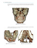 Tomografía Cone Beam 3D Atlas de Aplicaciones en Odontología - González