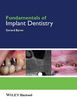 Fundamentals of Implant Dentistry - Byrne