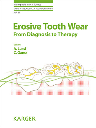 Erosive Tooth Wear From Diagnosis to Therapy - Lussi / Ganss