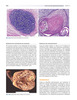 Manual de Oncología Médica MD Anderson 2Vols. – Kantarjian / Wolff / Koller