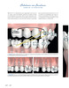 ORTODONCIA CON EXCELENCIA: LOGRO DE LA PERFECCION - Barbosa 2 Vols.