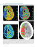 ATLAS DE RADIOLOGIA DE EMERGENCIA 2VOLS - BLOCK/ JORDANOV/ STACK/ THURMAN