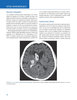 ATLAS DE RADIOLOGIA DE EMERGENCIA 2VOLS - BLOCK/ JORDANOV/ STACK/ THURMAN