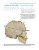 ESTRATEGIAS Y ABORDAJES EN NEUROCIRUGIA CRANEAL 2Vols - Garcia / Castillo