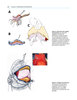 ESTRATEGIAS Y ABORDAJES EN NEUROCIRUGIA CRANEAL 2Vols - Garcia / Castillo