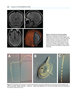 ESTRATEGIAS Y ABORDAJES EN NEUROCIRUGIA CRANEAL 2Vols - Garcia / Castillo