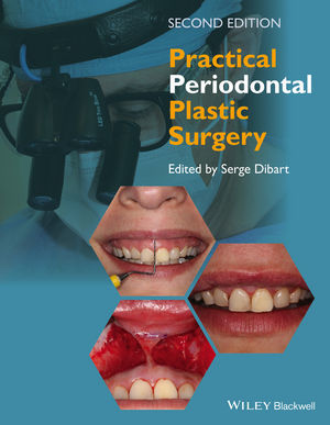 PRACTICAL PERIODONTAL PLASTIC SURGERY 2ED - Serge Dibart