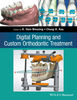 DIGITAL PLANNING AND CUSTOM ORTHODONTIC TREATMENT - Breuning