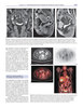 ULTRASONOGRAFIA EN GINECOLOGIA Y OBSTETRICIA 2VOL - Pastore