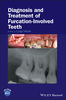 DIAGNOSIS AND TREATMENT OF FURCATION-INVOLVED TEETH - Nibali