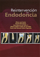 REINTERVENCION EN ENDODONCIA - Zuolo