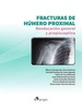 Fracturas de Húmero Proximal - Queipo De Llano