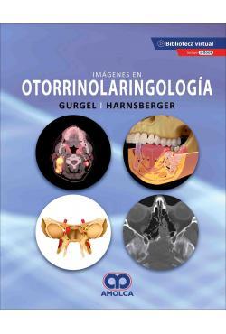 IMÁGENES EN OTORRINOLARINGOLOGÍA 2ed - Gurgel