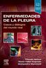 Enfermedades de la pleura.-  Sorino &  Feller-Kopman &  Marchett