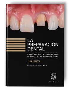 La preparación dental. Preparación de dientes para el éxito de las restauraciones. Jun Iwata - Lisermed