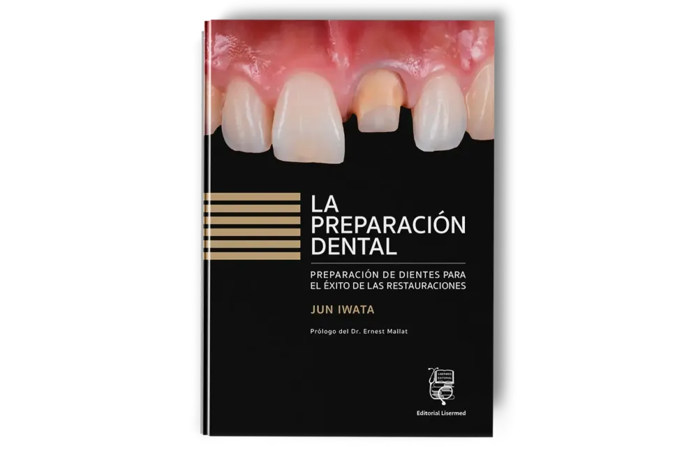 La preparación dental. Preparación de dientes para el éxito de las restauraciones. Jun Iwata - Lisermed