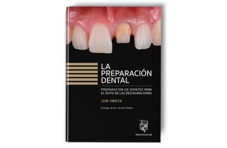 La preparación dental. Preparación de dientes para el éxito de las restauraciones. Jun Iwata - Lisermed