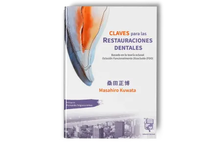 Claves para las Restauraciones Dentales. Masahiro Kuwata - Lisermed