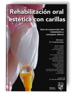 Rehabilitación Oral Estética con Carillas. Richard D. Trushkowsky - Lisermed