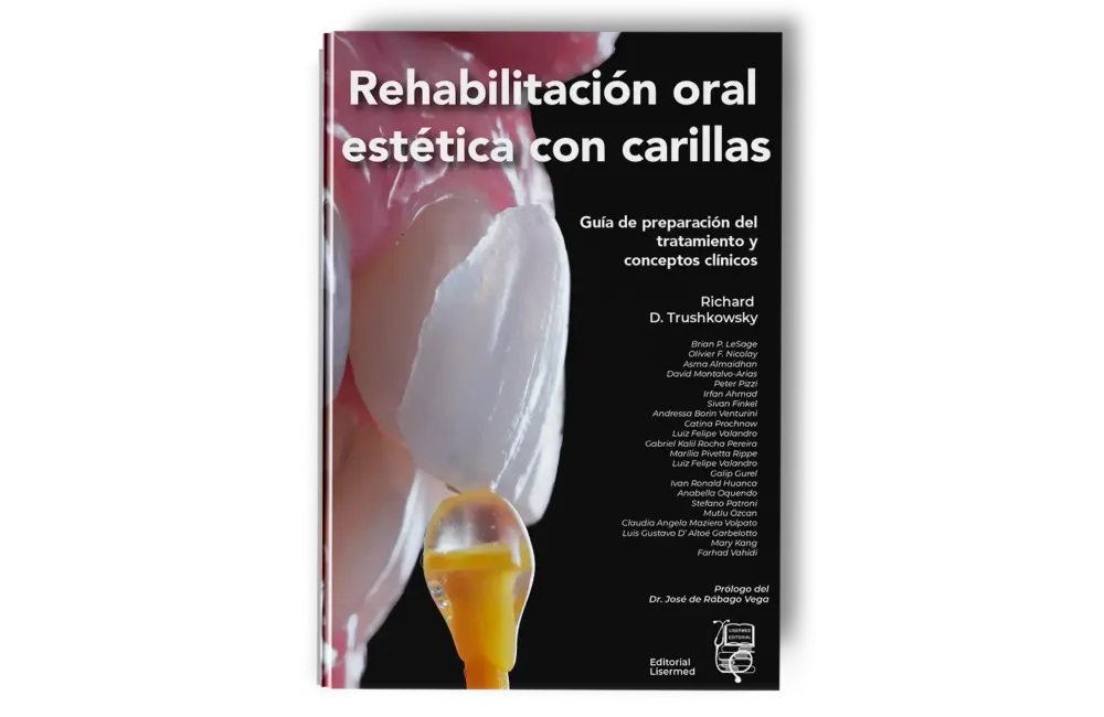 Rehabilitación Oral Estética con Carillas. Richard D. Trushkowsky - Lisermed