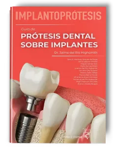 Implantoprótesis. Guía de Prótesis Dental Sobre Implantes. Jaime del Río Highgsmith - Lisermed