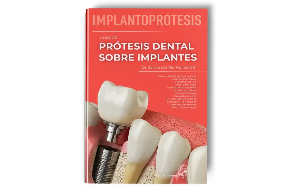 Implantoprótesis. Guía de Prótesis Dental Sobre Implantes. Jaime del Río Highgsmith - Lisermed