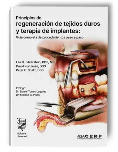 Principios de Regeneración de Tejidos Duros y Terapia de Implantes. Lee H. Silverstein - Lisermed