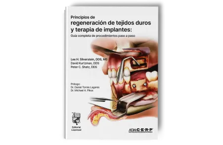 Principios de Regeneración de Tejidos Duros y Terapia de Implantes. Lee H. Silverstein - Lisermed