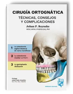 Cirugía Ortognática - Técnicas, Consejos y Complicaciones. Johan P. Reyneke - Lisermed