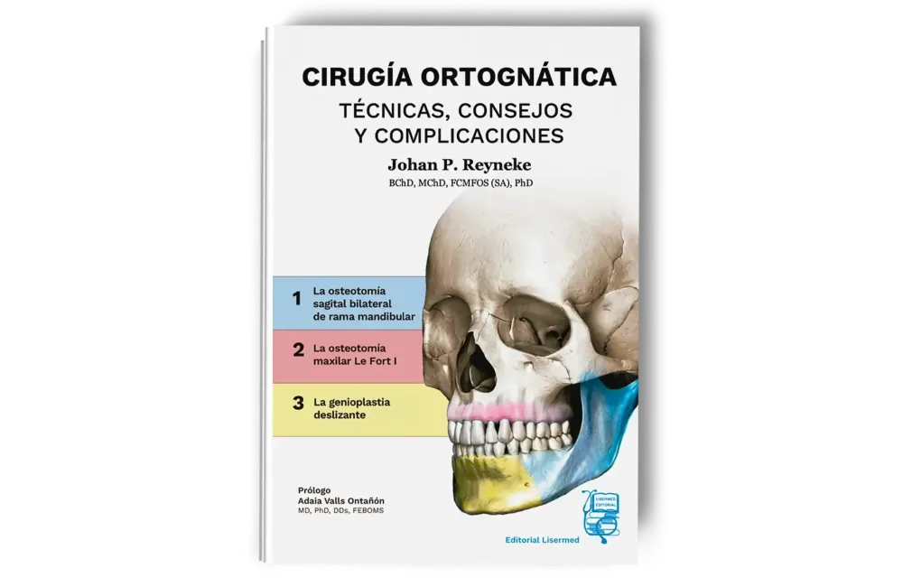 Cirugía Ortognática - Técnicas, Consejos y Complicaciones. Johan P. Reyneke - Lisermed