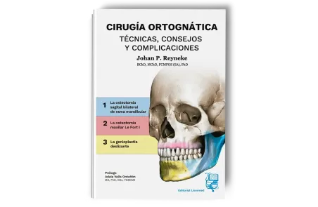 Cirugía Ortognática - Técnicas, Consejos y Complicaciones. Johan P. Reyneke - Lisermed