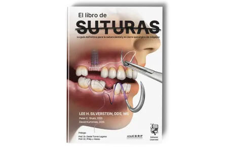 El Libro de Suturas. Guía Sutura Dental y Cierre Quirúrgico Colgajos. Lee H. Silvertein - Lisermed