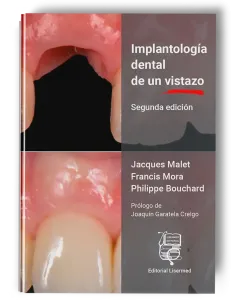Implantología Dental de un Vistazo - Jacques Malet / Francis Mora / Philippe Bouchard
