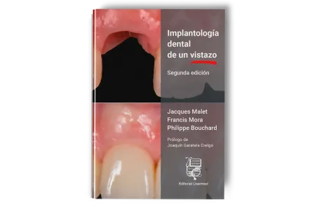 Implantología Dental de un Vistazo - Jacques Malet / Francis Mora / Philippe Bouchard