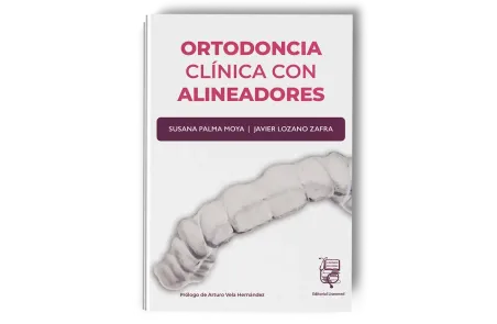 Ortodoncia Clínica con Alineadores