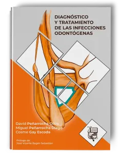 Diagnóstico y Tratamiento de la Infección Odontógena