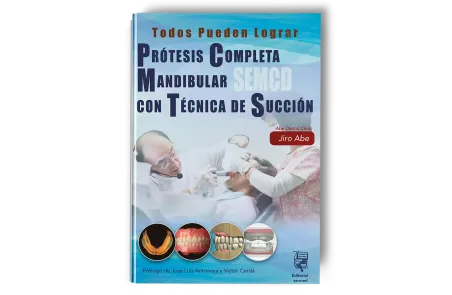Prótesis Completa Mandibular con Técnica de Succión Efectiva